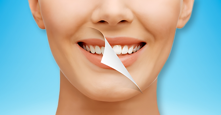 The Life-Changing Power of a Smile Makeover